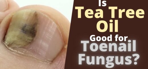 Best essential oils for combating fungal infections